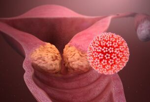Ποιες ασθένειες προκαλούν τον HPV